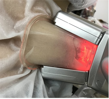 Doppelte Kanaltyp Cryolipolysis fette Gefriehrmaschine für Cellulite Redction