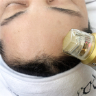 Thermisches abkühlendes Microneedling Bruch-Rf-Face lifting