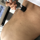 Körper-Schmerzlinderungs-Ultraschall-Physiotherapie-Maschinen-Stoßwellen-Therapie-Maschine